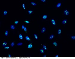 Sino Biological Anti-Ki67/MKI67 Antibody, Mouse Monoclonal, Quantity: Each