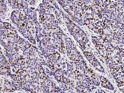 Sino Biological Anti-Ki67/MKI67 Antibody, Mouse Monoclonal, Quantity: Each