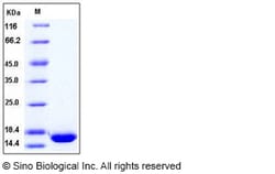 Sino Biological Human bFGF / FGF2 Protein 1mg, Quantity: Each of 1