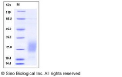 Sino Biological Recombinant Human GM-CSF/CSF2 Protein (His Tag), Quantity: