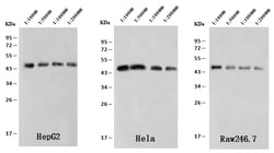 Sino Biological Human ACTB MAb 20ul (Sino Biological), Quantity: Each of