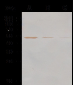 Sino Biological MERS-CoV NP-CoV PAb 20ul (Sino Biological), Quantity: Each