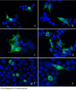 Sino Biological Anti-DYKDDDDK (FLAG epitope Tag) Antibody, Mouse MAb 100uL,