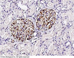 Sino Biological Anti-Nestin Antibody, Rabbit Polyclonal, Quantity: Each