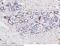 Sino Biological Anti-p63 Antibody, Rabbit Polyclonal, Quantity: Each of