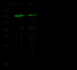 Sino Biological Anti-Androgen receptor Antibody, Rabbit Polyclonal, Quantity: