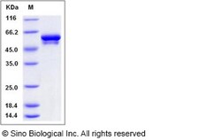 Sino Biological Recombinant Human Vimentin Protein (His Tag), Quantity:
