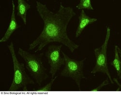 Sino Biological Anti-IRF6 Antibody, Mouse Monoclonal, Quantity: Each of