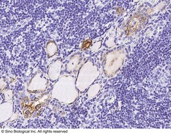 Sino Biological Anti-Cytokeratin 19/KRT19 Antibody, Rabbit Polyclonal,