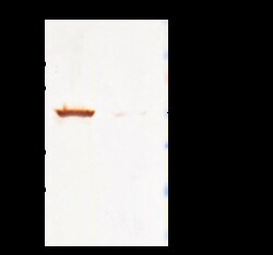 Sino Biological Anti-Cytokeratin 7/KRT7 Antibody, Rabbit Polyclonal, Quantity: