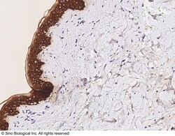 Sino Biological Recombinant Anti-Cytokeratin 5/KRT5 Antibody, Rabbit Monoclonal,