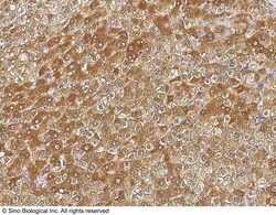 Sino Biological Anti-PIP/GCDFP 15 Antibody, Rabbit Polyclonal, Quantity: