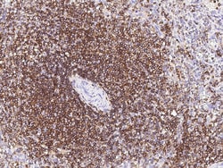Sino Biological Recombinant Anti-CD45 Antibody, Rabbit Monoclonal, Quantity: