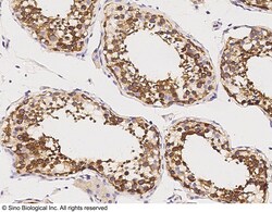 Sino Biological Recombinant Anti-GDF3 Antibody, Rabbit Monoclonal, Quantity: