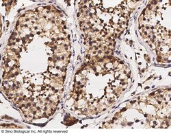 Sino Biological GDF3 Antibody, Rabbit PAb, Antigen Affinity Purified 100uL,