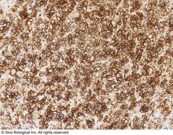 Sino Biological Alkaline Phosphatase / ALPL Antibody, Rabbit MAb 100uL,