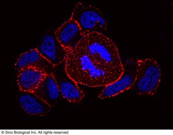 Sino Biological Anti-CD10/Neprilysin Antibody, Rabbit Polyclonal, Quantity: