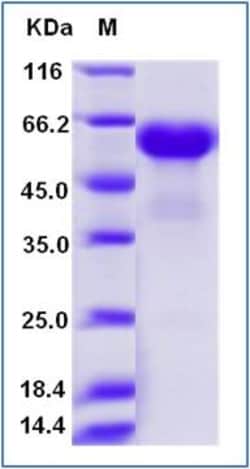 Sino Biological Recombinant Human 4-1BB/CD137 Protein (ECD, hFc Tag), HPLC-verified,