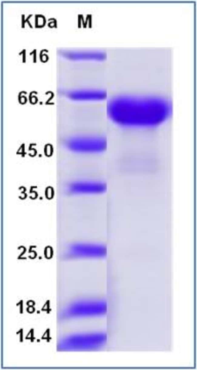 Sino Biological Human CD137 / 4-1BB Protein (ECD, Fc Tag) 1mg, Quantity ...