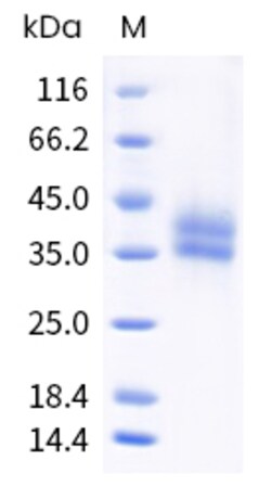 Sino Biological Recombinant Human 4-1BB/CD137 Protein (ECD, His & AVI Tag),