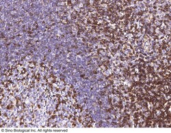 Sino Biological Anti-IFITM1/CD225 Antibody, Rabbit Polyclonal, Quantity: