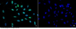 Sino Biological Anti-HNF1A Antibody, Rabbit Polyclonal, Quantity: Each