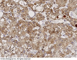 Sino Biological Anti-NEUROD1 Antibody, Rabbit Polyclonal, Quantity: Each