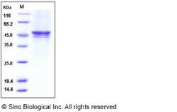 Sino Biological Human GSK3B Protein (His Tag) 50ug, Quantity: Each of 1