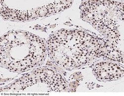 Sino Biological Lin28A Antibody, Rabbit PAb, Antigen Affinity Purified