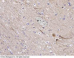 Sino Biological Anti-Neurofilament Heavy Antibody, Rabbit Polyclonal, Quantity: