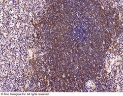Sino Biological Anti-CCR1 Antibody, Rabbit Polyclonal, Quantity: Each of