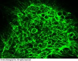 Sino Biological Anti-CCR1 Antibody, Rabbit Polyclonal, Quantity: Each of
