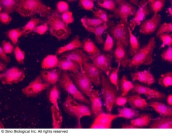 Sino Biological Recombinant Anti-SPARCL1 Antibody, Rabbit Monoclonal, Quantity: