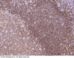 Sino Biological CD35 Antibody, Rabbit PAb, Antigen Affinity Purified 100uL,