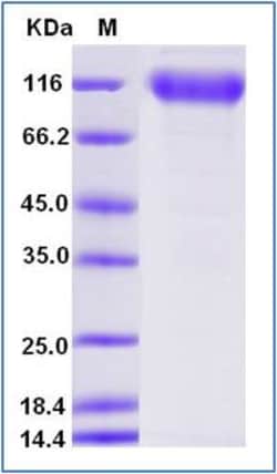 Sino Biological Human TrkB Protein (Fc Tag) 100ug, Quantity: Each of 1