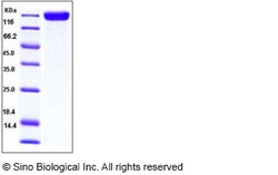 Sino Biological Recombinant Human TrkC Protein (His & hFc Tag), Quantity: