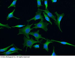 Sino Biological Anti-TrkC Antibody, Mouse Monoclonal, Quantity: Each of