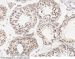 Sino Biological Anti-CD203c/ENPP-3 Antibody, Rabbit Polyclonal, Quantity: