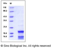 Sino Biological Recombinant Human Caspase-7 Protein (His Tag), Quantity: