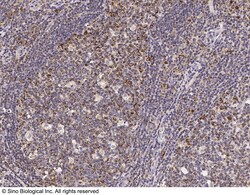 Sino Biological KIR3DL3 / CD158z Antibody, Rabbit PAb, Antigen Affinity