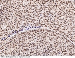 Sino Biological Anti-ZMYM2 Antibody, Rabbit Polyclonal, Quantity: Each
