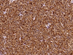 Sino Biological Recombinant Anti-S100B Antibody, Rabbit Monoclonal, Quantity: