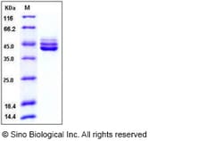 Sino Biological Recombinant Human IL-12 p40/IL12B Protein (His Tag), Quantity:
