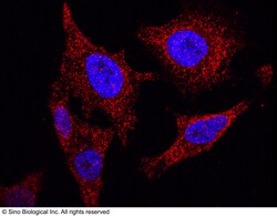 Sino Biological Anti-NANOS1 Antibody, Rabbit Polyclonal, Quantity: Each