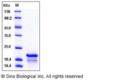 Sino Biological Human NPM1 / Nucleophosmin Protein (His Tag) 100ug, Quantity: