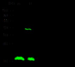 Sino Biological Anti-RCAN1 Antibody, Rabbit Polyclonal, Quantity: Each