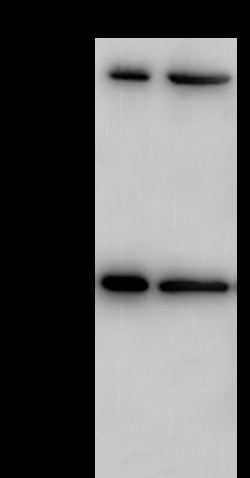Sino Biological Endoglin / CD105 / ENG Antibody, Rabbit PAb, Antigen Affinity