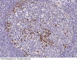 Sino Biological Anti-Integrin alpha V/ITGAV Antibody, Rabbit Polyclonal,