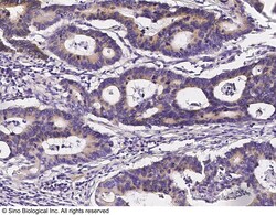 Sino Biological Anti-MAP2 Antibody, Rabbit Polyclonal, Quantity: Each of