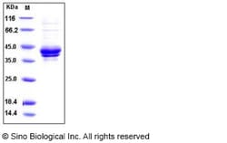 Sino Biological Recombinant Human HVEM Protein (ECD, hFc Tag), Quantity: